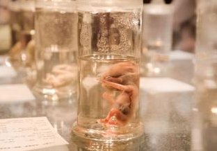 2026年赴美做试管婴儿家庭应该怎样选择医院一文便知？