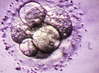 揭晓试管移植后呕吐的4大原因，移植后呕吐有什么影响