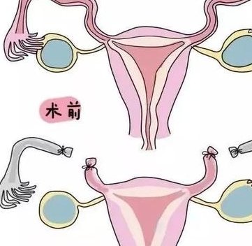 桦甸正规生殖医院中哪些有获得批准开展试管婴儿技术？