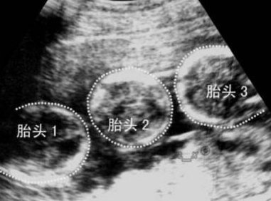 2026年口碑榜单揭晓：商丘优质助孕机构推荐前三甲！